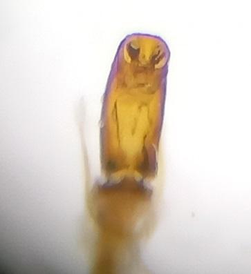 Rhizophagus sp.